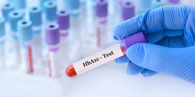 HbA1c 