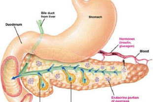 metabolikus szindróma, cukorbetegség, hasnyálmirigy, diabetesz